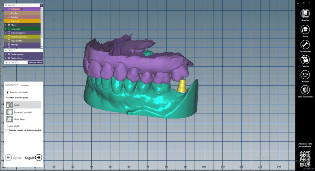 Fig 6b - Baixe as bibliotecas 3shape, Dental Wings e Exocad