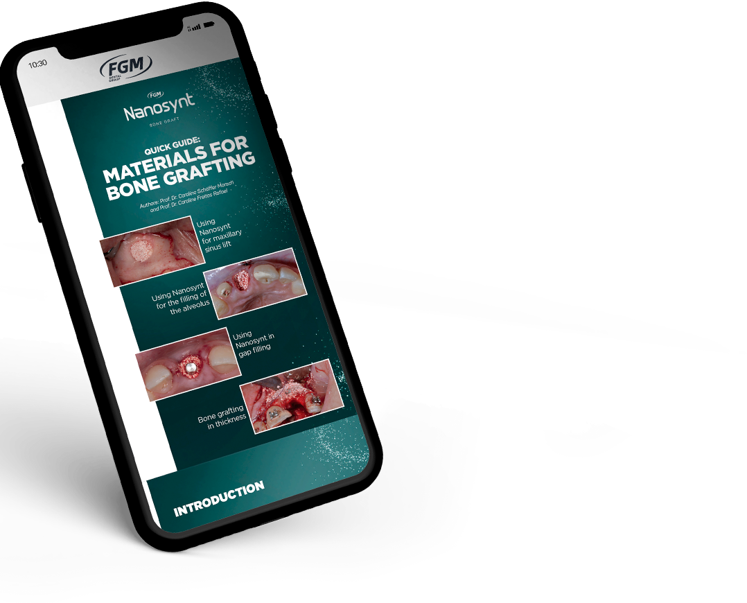 Bone Grafting Quick guide FGM Dental Group