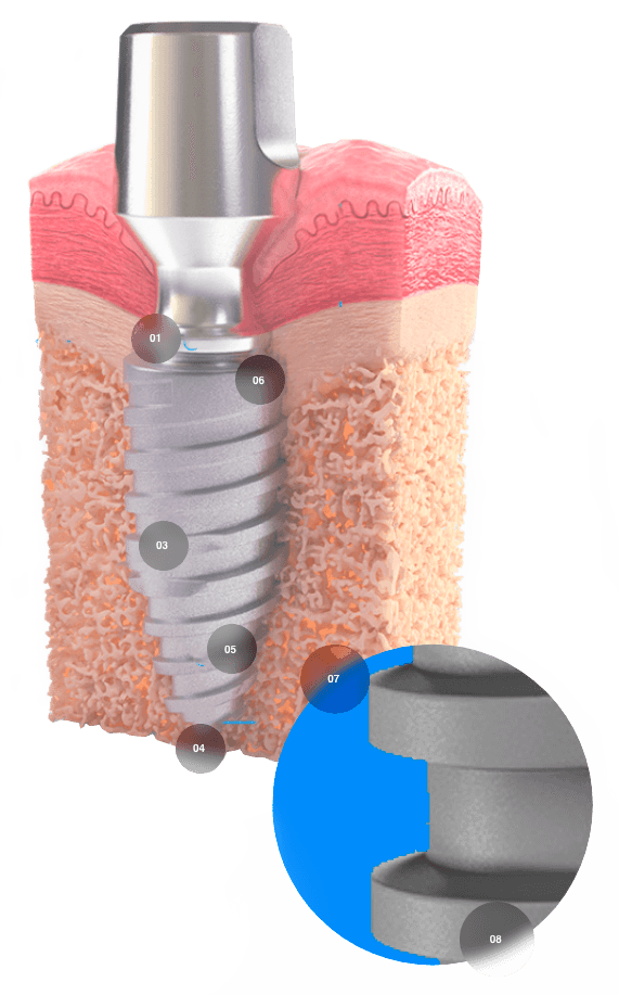 sec7 2 1 - Sistema de Implantes Arcsys