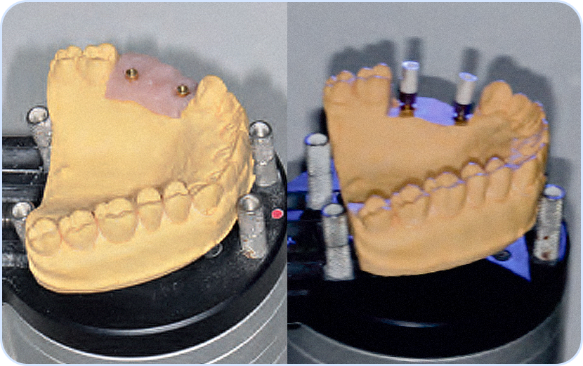 03 O modelo de trabalho fisico e escaneado pelo laboratorio. Essa etapa origina um arquivo digital passivel de edicao em softwares especificos - Fluxo Digital