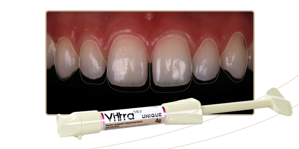 10_Capa-Clareamento-dental-em-dente-restaurado-com-resina-unicromática-Vittra-APS-Unique