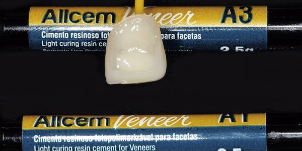 Cimento Resinoso Fotopolimerizável Allcem Veneer cor A3 na cervical e A1 na incisal