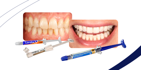 Capa-clareamento-bordas-incisais