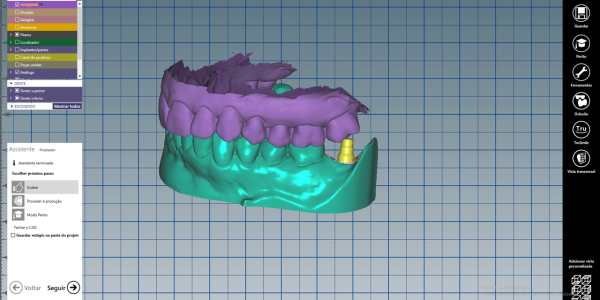 Fig. 6b Arquivo STL do arco inferior e superior em oclusão e a relação do link metálico selecionado na biblioteca Arcsys, sobre pilar com o antagonista.