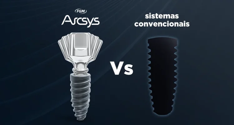 Inovação e Versatilidade Arcsys vs Sistemas convencionais de implantes copy