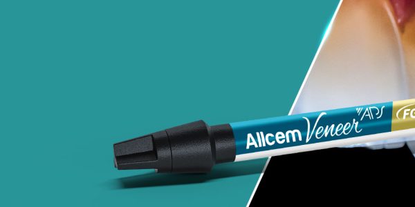 Allcem Veneer APS: qualidade reconhecida pela Reality Ratings